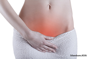 bacterial vaginosis 1 bacterial vaginosis 1