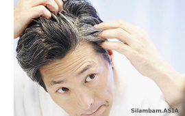 Hair Graying 1 Hair Graying 1